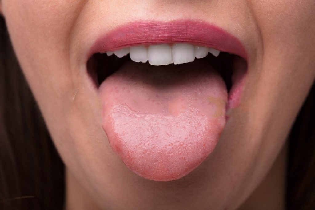 How A Coating On The Back Of Tongue Cause Bad Breath?