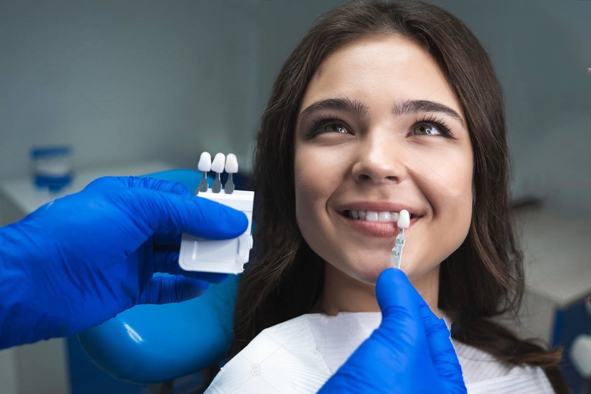 Bluish Enamel Is An Adverse Effect Of Teeth Bleaching
